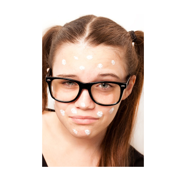 Chapstick's New Ad Offensive? We Think We Have Seen Worse