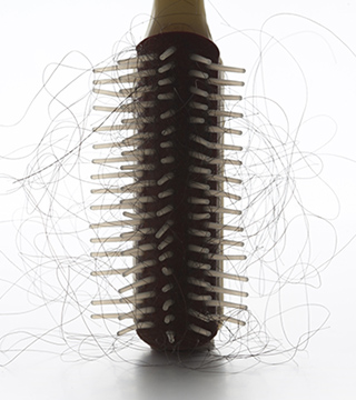 How Determine If Your Hair Loss is Normal