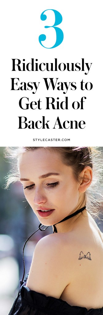 how-to-get-rid-of-back-acne
