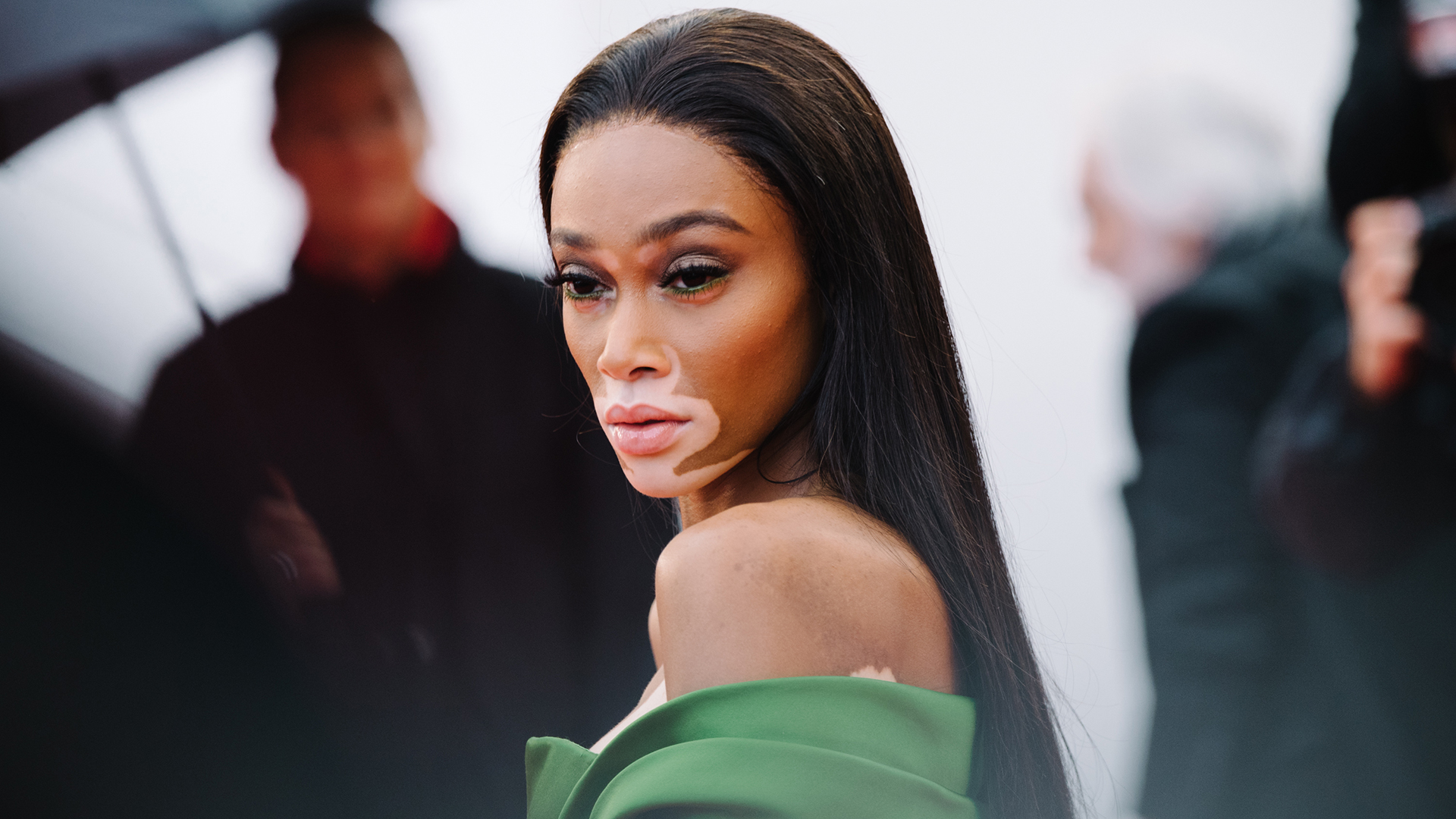 Winnie Harlow