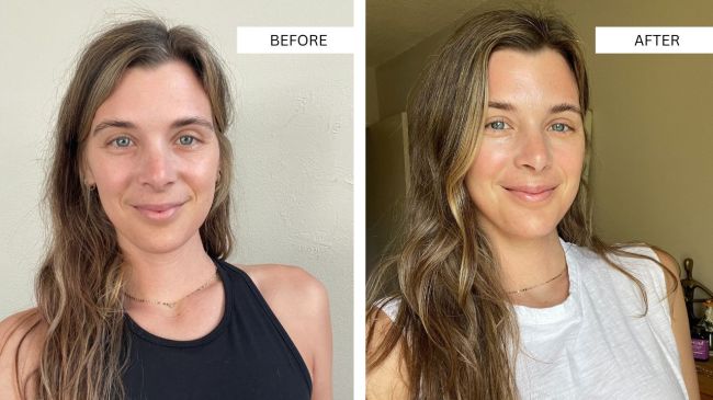 Before and after using the Peace Out Skincare Face Mask